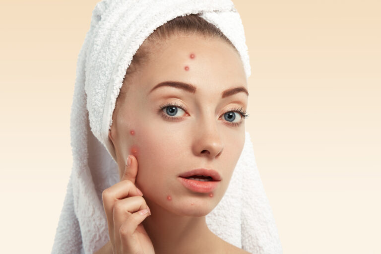 Unveiling the No.1 Secret to Flawless Skin: Clean and Clear Acne Spot Treatment Revealed!