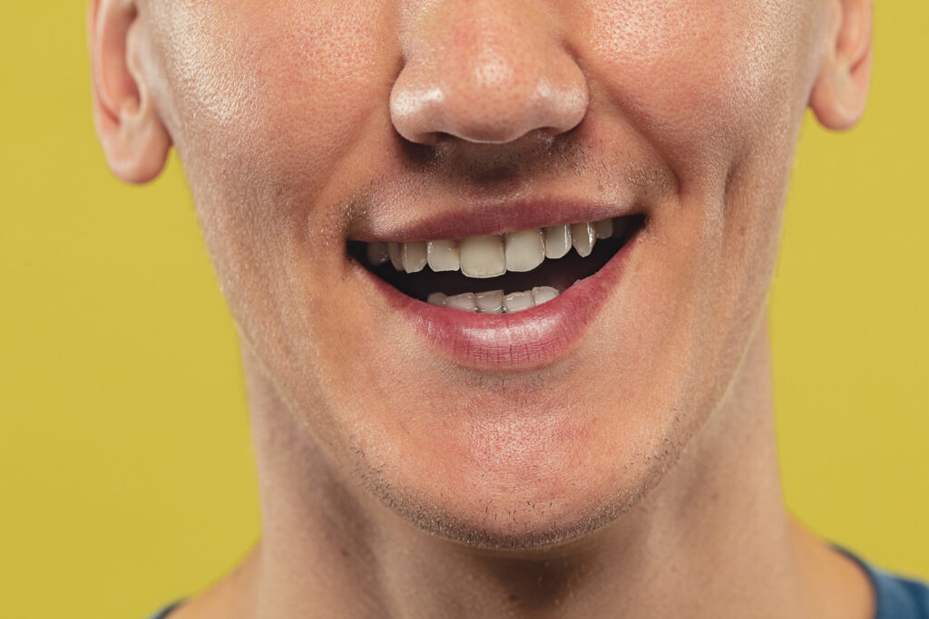 How to Get Rid of Yellow Teeth at Home