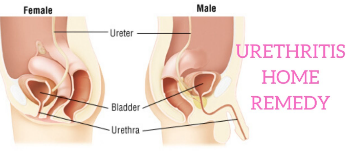 How to Cure Urethritis Naturally
