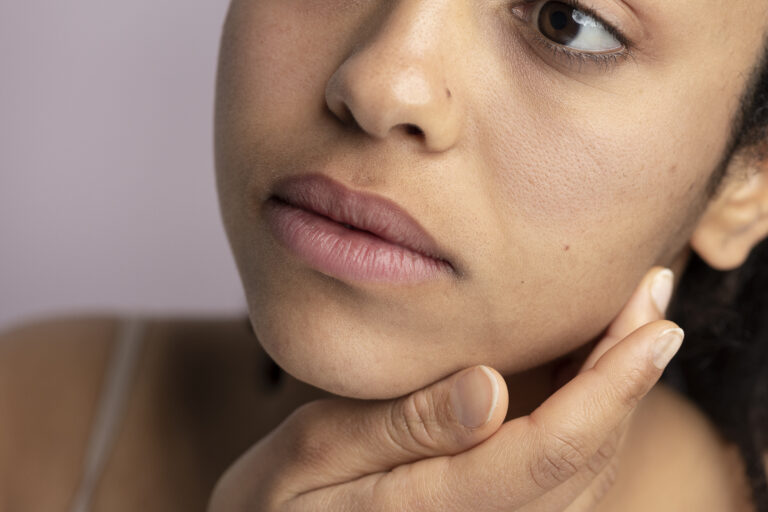 Discover the No. 1 Secret : How to Get Rid of Large Skin Pores at Home Naturally